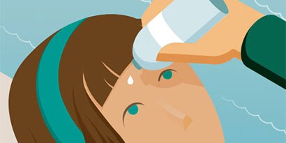 ¡UN REGALO PARA LA VISTA! CONSEJOS PARA LESIONES OCULARES
